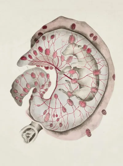 Amniotic Sac Bovine With Cotyledonary Placenta
