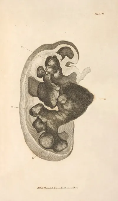 An Essay On The Chemical History And Medical Treatment Of Calculous Disorders Pl 8
