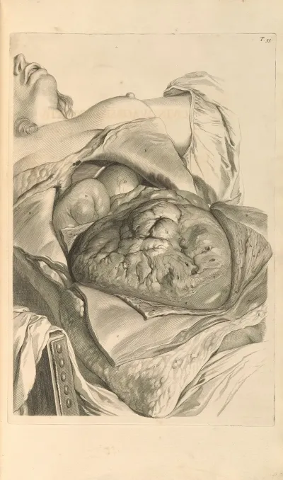 Anatomia Humani Corporis Pl 056