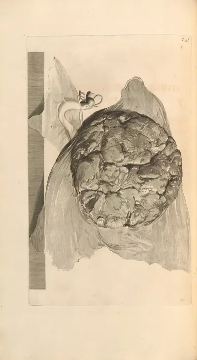Anatomia Humani Corporis Pl 059