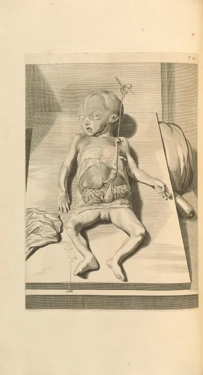 Anatomia Humani Corporis Pl 063