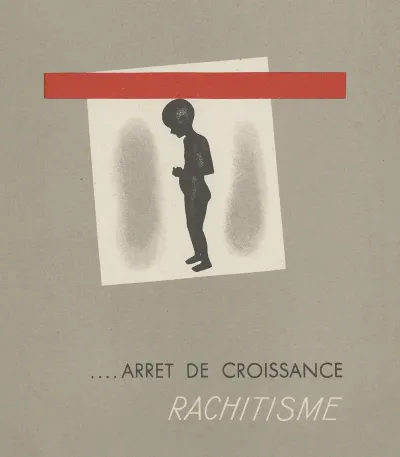 Arret De Croissance Rachitisme