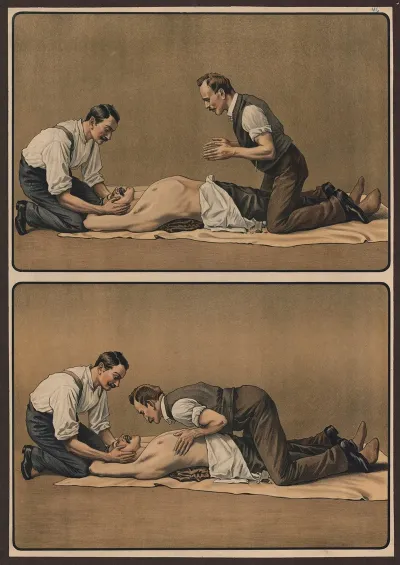 Artificial Respiration