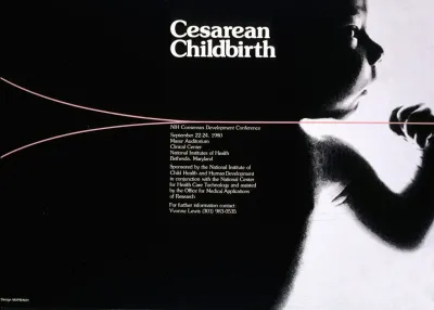Cesarean Childbirth