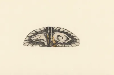 Cross Section Of Bladder