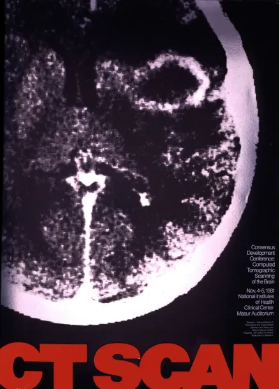 Ct Scan