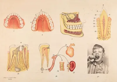 Dental Hygiene