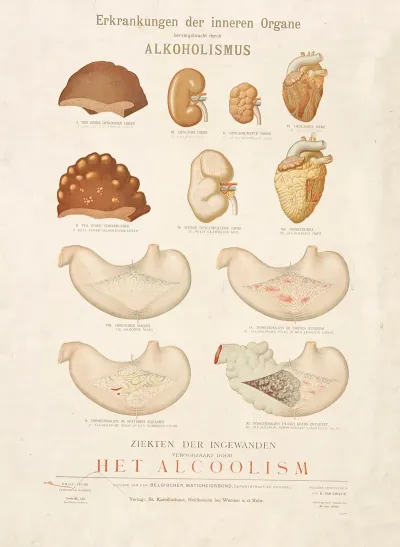 Diseases Of The Internal Organs Caused By Alcoholism