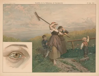 Eye