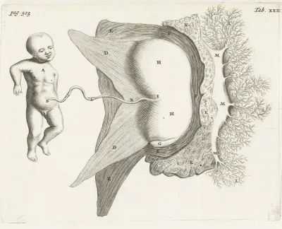 Fetus Still Connected To The Uterus By The Umbilical Cord