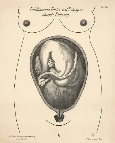 Full Term Fetus At The End Of Pregnancy