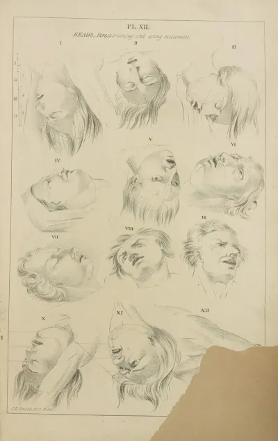 Heads Foreshortening And Strong Excitements