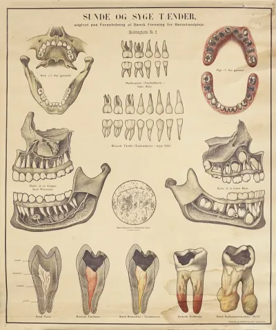 Healthy And Unhealthy Teeth