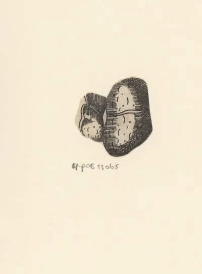 Kidney 2