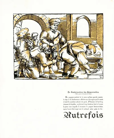 La Cauterisation Des Hemorroides