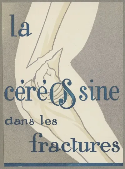 La Cereosine Dans Les Fractures