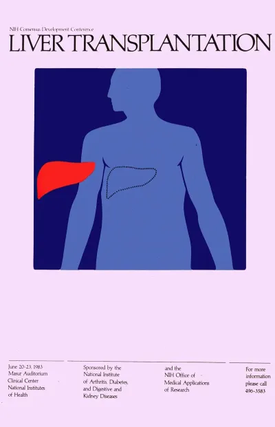Liver Transplantation
