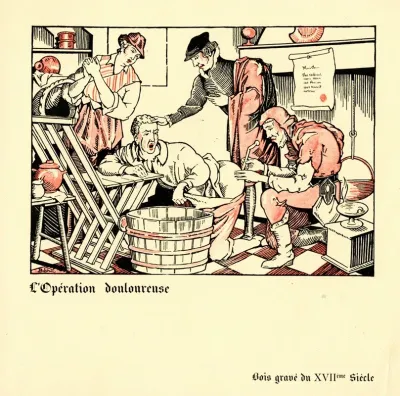 Loperation Douloureuse