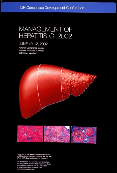 Management Of Hepatitis C