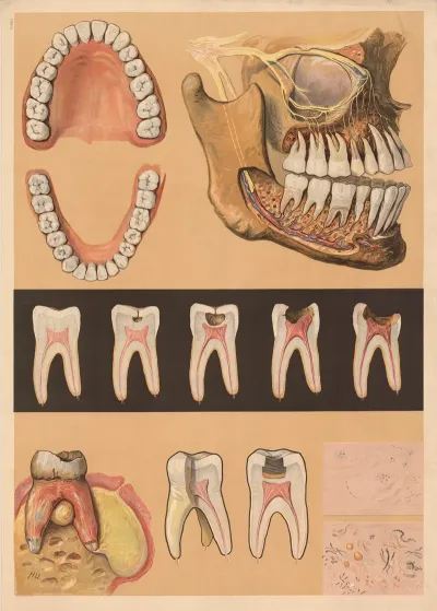 Meinholds Dental Chart