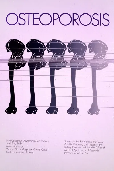 Osteoporosis