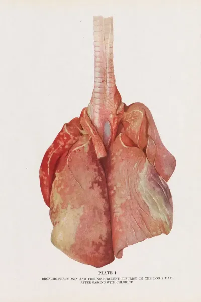 Plate I Frontispiece Broncho Pneumonia And Fibrino Purulent Pleurisy In A Dog 8 Days After Gassing With Chlorine