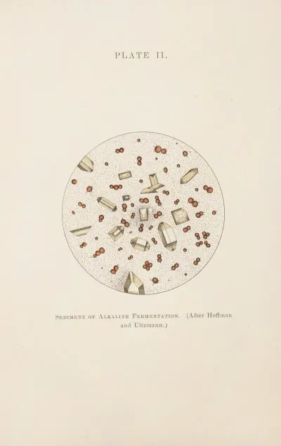 Plate Ii Sediment Of Alkaline Fermentation