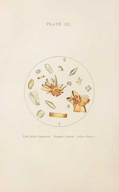 Plate Iii Uric Acid Crystals Normal Color
