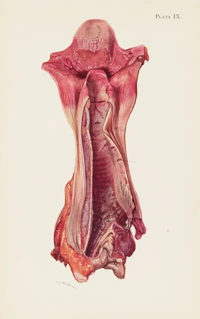 Plate Ix Ulceration Of Trachea By Mustard Gas