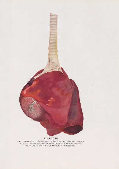 Plate Xiii Fig 1 Heart And Lungs Of Dog Dying 12 Hours After Chlorpicrin Gassing