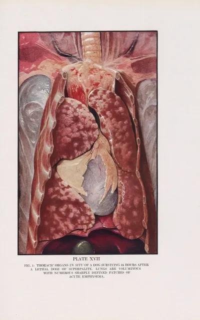 Plate Xvii Fig 1 Thoracic Organs In Situ Of A Dog Surviving 24 Hours After A Lethal Dose Of Superpalite