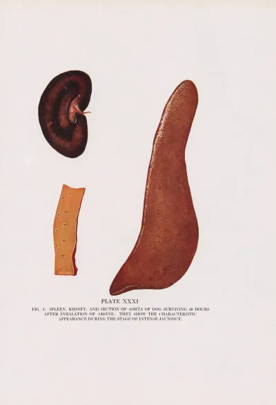 Plate Xxxi Fig 3 Spleen Kidney And Section Of Aorta Of Dog Surviving 49 Hours After Inhalation Of Arsine