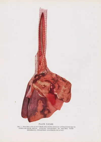 Plate Xxxiii Fig 1 Trachea And Lungs From Dog Dying 1 Day After Exposure To Ethyldichlorarsine