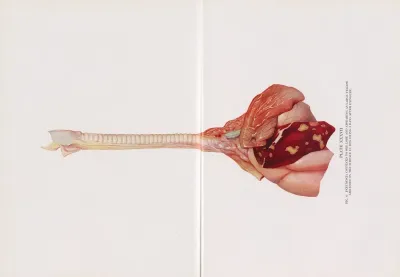 Plate Xxxvii Fig 6 Pneumonia Confined To One Lobe And Appearing As Large Yellow Abscesses On The Surface In Dog Dying 5 Days After Exposure