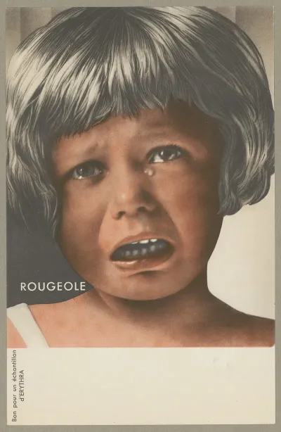 Rougeole Erythra