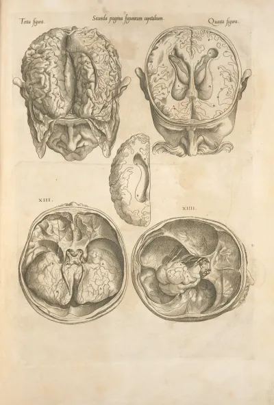 Secunda Pagina Figurarum Capitalium Human Brain