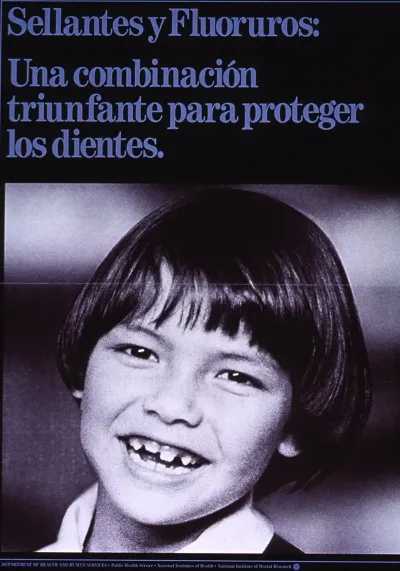 Sellantes Y Fluoruros Una Combinacion Triunfante Para Proteger Los Dientes