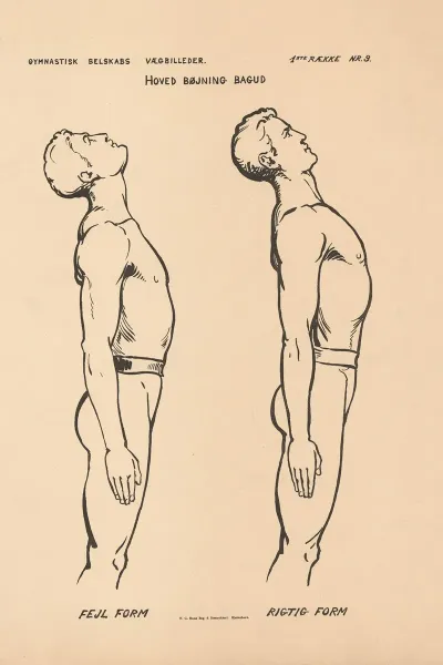 Standing Head Bending Backwords Wrong Form Right Form Hoved Bojning Bagud