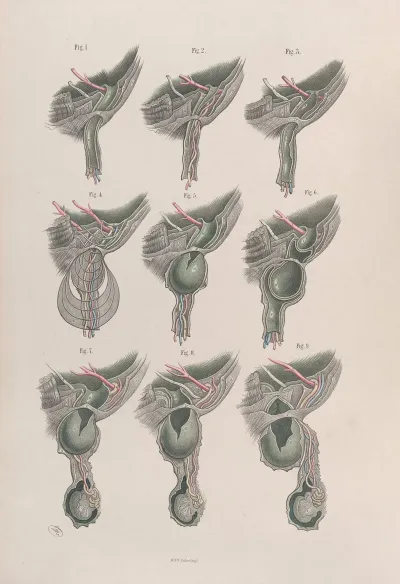 Surgical Anatomy Pl 33