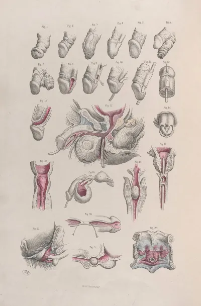 Surgical Anatomy Pl 44