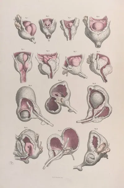 Surgical Anatomy Pl 46