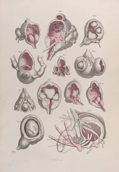 Surgical Anatomy Pl 47