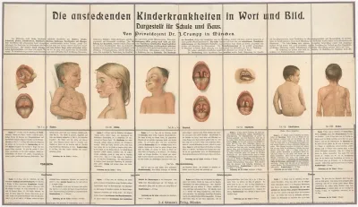 Table Of Infectious Childhood Diseases