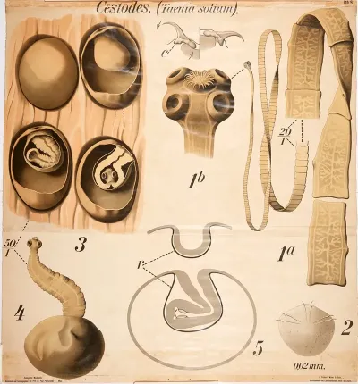 Tapeworm