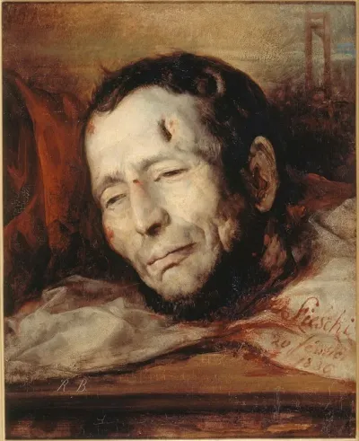 Tete De Giuseppe Fieschi 1790 1836 Apres Son Execution 2