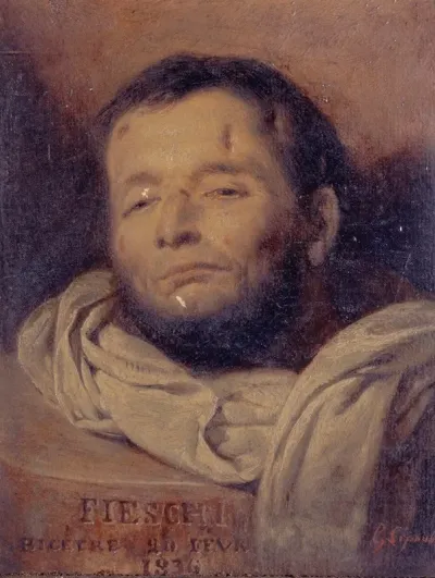 Tete De Giuseppe Fieschi 1790 1836 Apres Son Execution