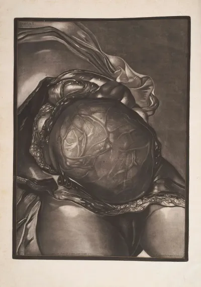 The Abdomen Laid Open With The Uterus Injected And Displayed Immediately As Laid Under The Teguments
