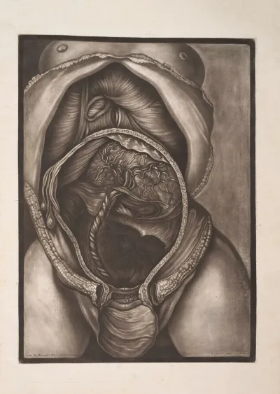 This Represents The Inferior Surface Of The Diaphragm And The Cavity Of The Uterus With The Placenta Adhering To It