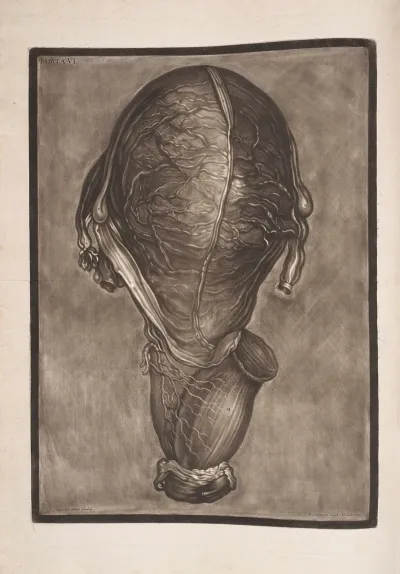 This Represents The Uterus Removed Out Of The Pelvis And The Connections Of The Rectum With The Vagina