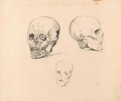Three Studies Of The Skull Of Jacobean Antonio Timmerman From Dunkirk